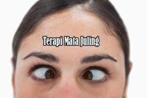 Terapi Mata Juling