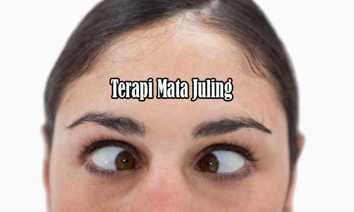 Terapi Mata Juling